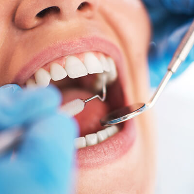The dentist cleaning a woman's teeth using two dental instruments in her mouth.