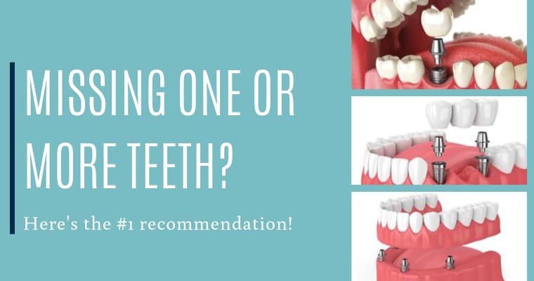 Missing one or more teeth? Here's the #1 recommendation!